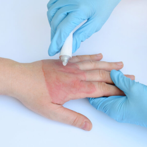 Применение